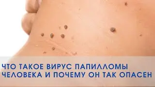 ЧТО ТАКОЕ ВИРУС ПАПИЛЛОМЫ ЧЕЛОВЕКА И ПОЧЕМУ ОН ТАК ОПАСЕН