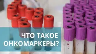 🧪 Онкомаркеры: что это такое, и когда нужно сдавать анализ на онкомаркеры? Онкомаркеры что это. 18+