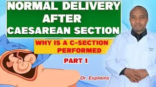 IS IT POSSIBLE TO HAVE NORMAL DELIVERY AFTER CAESAREAN SECTION? REASONS WHY C-SECTION IS DONE Part 1