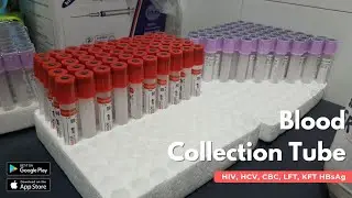 Blood Collection Tubes for LFT, KFT, CBC, HIV, HCV, and HBsAg