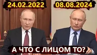 От Киева за 3 дня до санитарной зоны в Курске – Путин прервал молчание