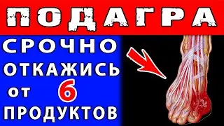 ЗАПРЕЩЕННЫЕ ПРОДУКТЫ при ПОДАГРЕ 👍 Это НАДО ЗНАТЬ !