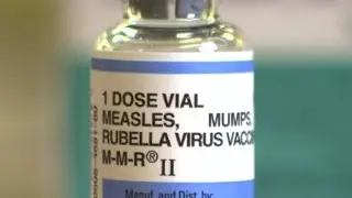 How to see the signs of measles