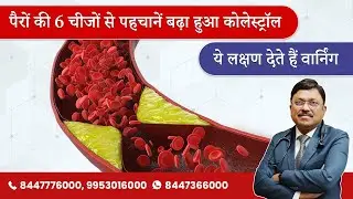 पैरों की 6 चीजों से पहचानें बढ़ा हुआ कोलेस्ट्रॉल | High Cholesterol - Symptoms &  Causes | SAAOL