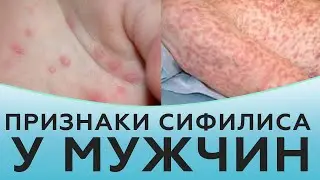 Признаки сифилиса у мужчин