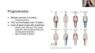 Virtual Resident Lecture Series: ALS Palliative Care - American Academy of Neurology