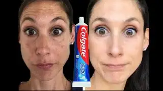 Глубокая чистка и отбеливание лица!Антивозрастная маска!skin care