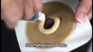 How to use Stomahesive® Paste