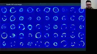 CNNs reveal crucial degeneracies in strong lensing subhalo detection