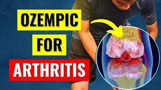 What Science ACTUALLY Says About Ozempic / Wegovy / Zepbound for Arthritis