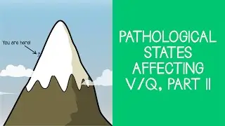 3.5 Respiratory: Pathological States affecting V/Q, Part 2