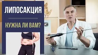 ЛИПОСАКЦИЯ 🤭 ТЕСТЫ НА ЛИПОСАКЦИЮ ЖИВОТА, БЕДЕР, НОГ, РУК