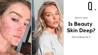 Why Unhealthy Skin Affects Your Appearance | What Makes A Face Attractive Ep. 9