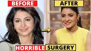 SHOCKING Plastic Surgery of Bollywood Actresses BEFORE & AFTER | Anushka Sharma, Rakhi Sawant