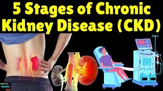 5 Stages of Chronic Kidney Disease (CKD) | Stages of Chronic Kidney Disease (CKD Stages) Explained