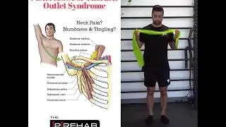 7 Exercises for Thoracic Outlet Syndrome