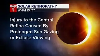 Safer viewing experience of the solar eclipse