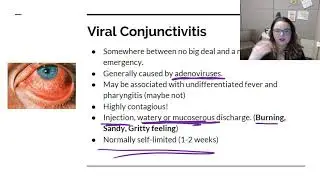 Bacterial and Viral Conjunctivitis