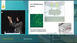 COAGULOPATHIES (GUIDE) Beverley Hunt  ISICEM 2023