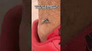 POV: Cuando te PICA un MOSQUITO...🦟😡 #humor #comedia #shorts