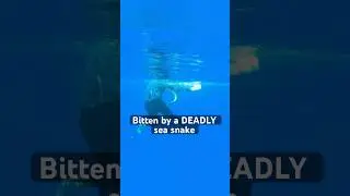 Bitten by a DEADLY Sea Snake! 