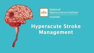 Understanding Stroke: Types and Symptoms of Stroke