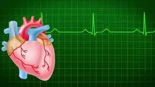 ECG ( Electrocardiogram) 