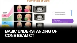 Basic understanding of cone beam CT