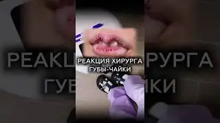 Губы-чайки 