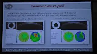 Помутнение роговицы + смешанный астигматизм