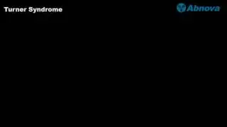 Turner Syndrome