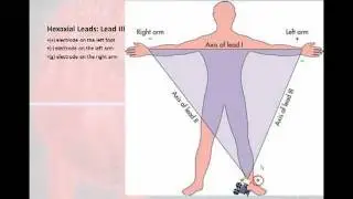 12 Lead Interpretation Part 1: Introduction to the 12 Lead EKG