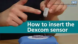 How to insert the Dexcom sensor