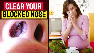 How To Clear Blocked Nose During Pregnancy | Stuffy Nose In Pregnancy