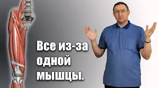 Из-за ЭТОЙ мышцы возникает плоскостопие,вальгус боль в спине и шее.