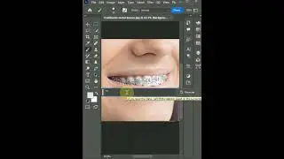 Remove Teeth Braces Using Generative Fill in Adobe Photoshop (Beta)