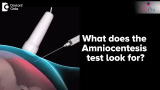 What does the Amniocentesis test look for? - Dr. Sahana K P