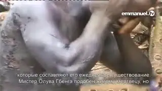 Исцеление болезни на коже - во имя Иисуса Христа. Пророк ТБ Джошуа