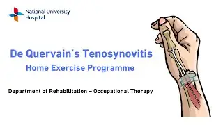 Management of De Quervain's Tenosynovitis: Home Exercise Programme and Splinting