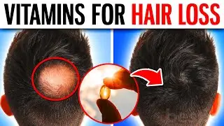 10 POWERFUL Vitamins That Prevent Hair Loss