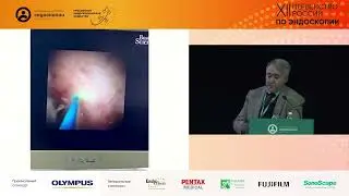 Первый опыт применения SpyGlass при лазерной литотрипсии конкрементов протока поджелудочной железы