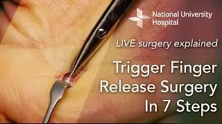 LIVE Surgery Explained: Trigger Finger Release Surgery in 7 Steps