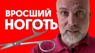 Вросший ноготь лечение в домашних условиях. Первая помощь