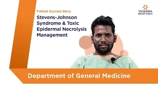 Stevens-Johnson Syndrome and Toxic Epidermal Necrolysis Management | Yashoda Hospitals Hyderabad