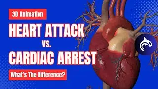 Cardiac Arrest vs Heart Attack - What's the Difference? - 3D Animation