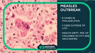 9 total measles cases reported in and around Philadelphia, health department said