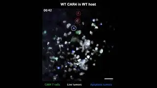 Immunotherapy for blood cancer: Remote destruction of tumor cells demonstrated