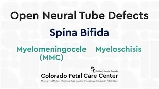 Spina Bifida: Myelomeningocele (MMC)