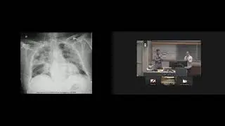 COVID-19: Pathophysiology, Clinical Management, Therapeutic Evidence and Ongoing Trials