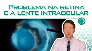 Quem tem problema na retina pode implantar lente intraocular?